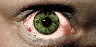 Biotech Company Horizon Therapeutics Shares Jump on Takeover Bid